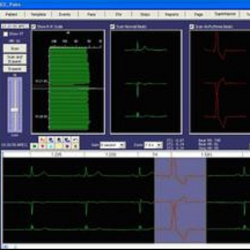 HolterCare1 Software